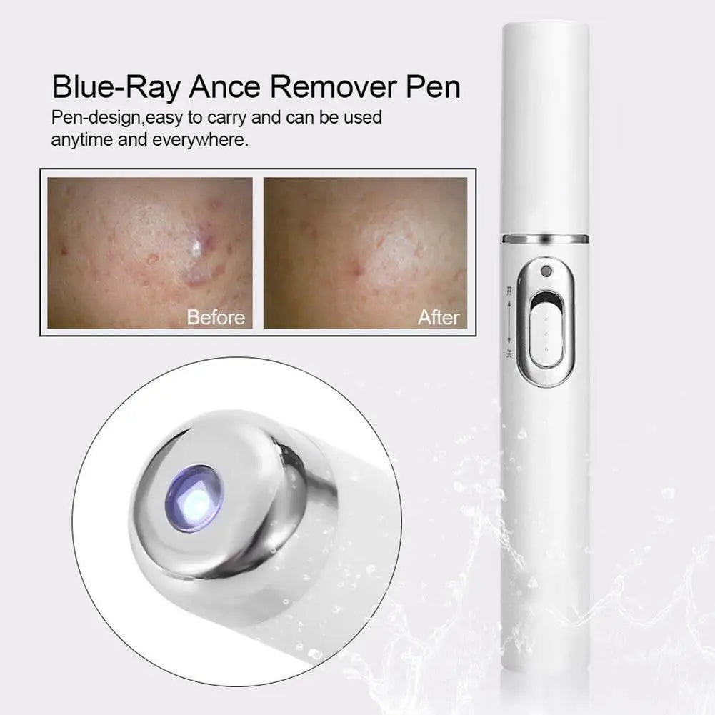Heath Blue Light Therapy Varicose Veins Treatment Laser Pen Soft Scar Wrinkle Removal Treatment Acne Laser Pen Massage Relax ﻿