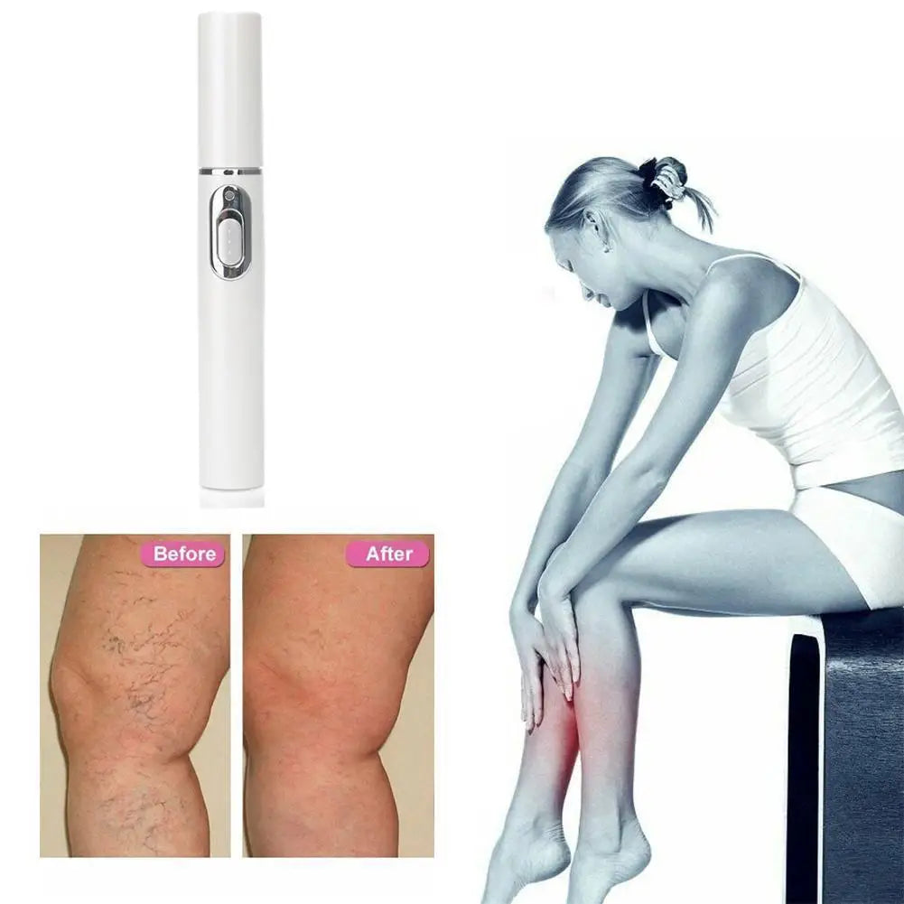 Heath Blue Light Therapy Varicose Veins Treatment Laser Pen Soft Scar Wrinkle Removal Treatment Acne Laser Pen Massage Relax ﻿