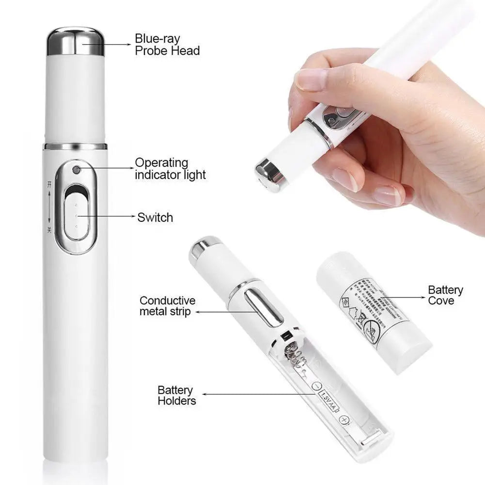 Heath Blue Light Therapy Varicose Veins Treatment Laser Pen Soft Scar Wrinkle Removal Treatment Acne Laser Pen Massage Relax ﻿