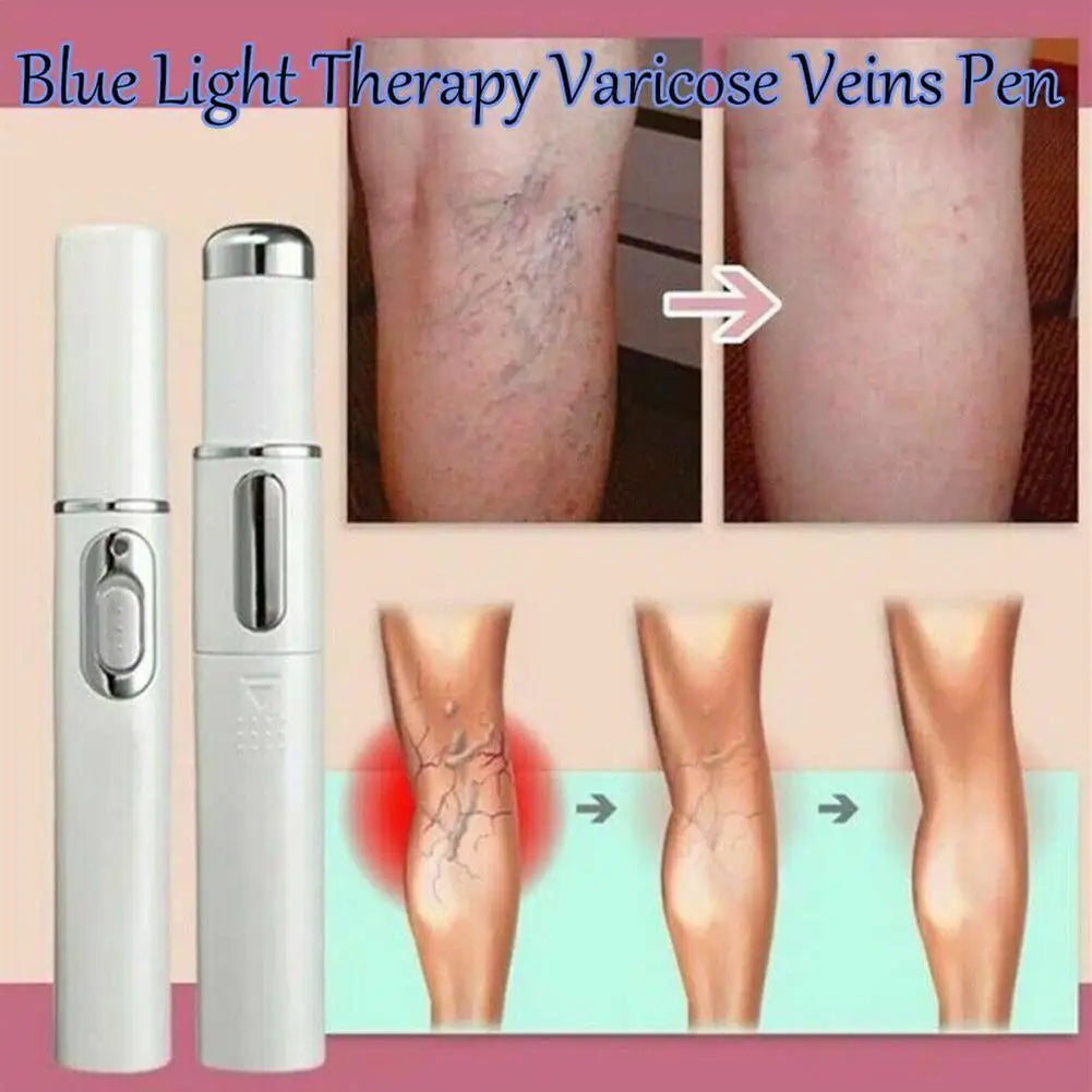Heath Blue Light Therapy Varicose Veins Treatment Laser Pen Soft Scar Wrinkle Removal Treatment Acne Laser Pen Massage Relax ﻿