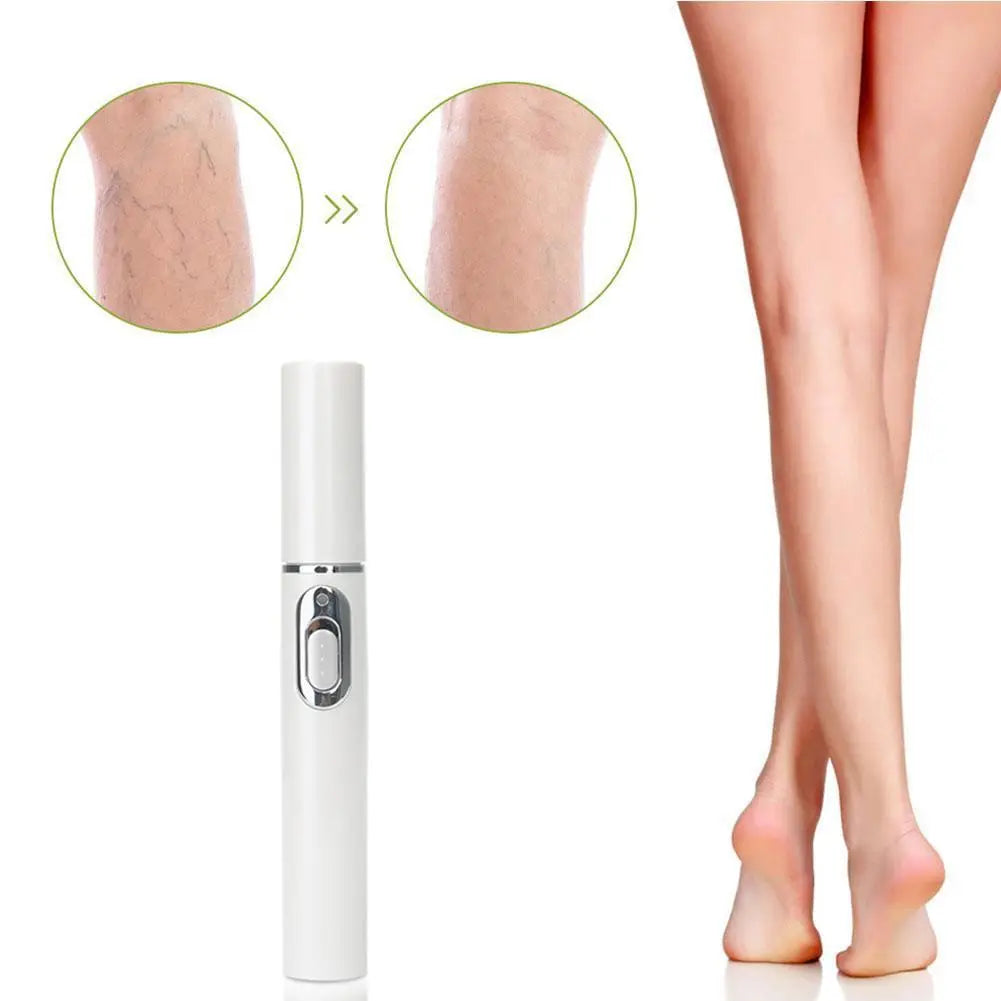 Heath Blue Light Therapy Varicose Veins Treatment Laser Pen Soft Scar Wrinkle Removal Treatment Acne Laser Pen Massage Relax ﻿